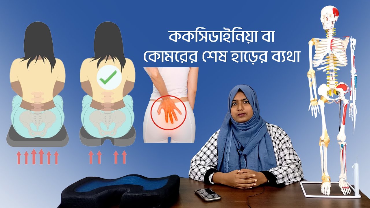 ককসিডাইনিয়া বা কোমরের শেষ হাড়ের ব্যথা | মেরুদন্ডের শেষ অংশে ব্যথা