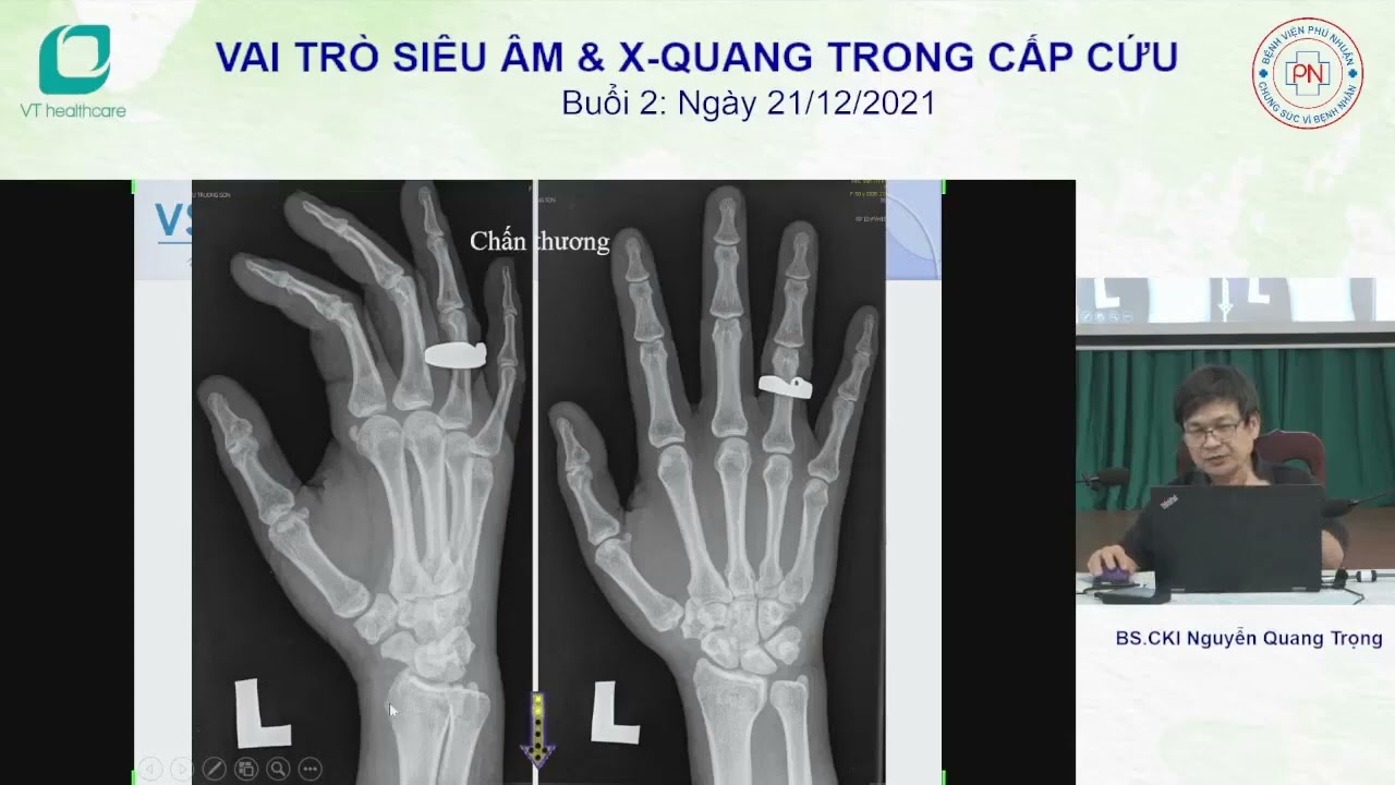Đọc phim X quang xương khớp - BS Nguyễn Quang Trọng