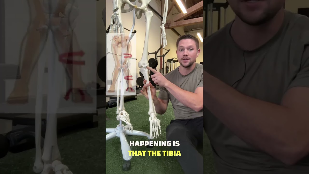 The BEST Knee Valgus Fix & Explanation #kneepain #kneepainrelief #kneepainexercises #squats #gym