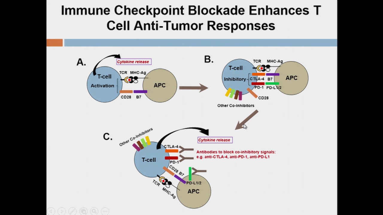 Immunotherapy Now and Future for Metastatic Renal Cell Carcinoma Jianjun Gao, MD, PhD