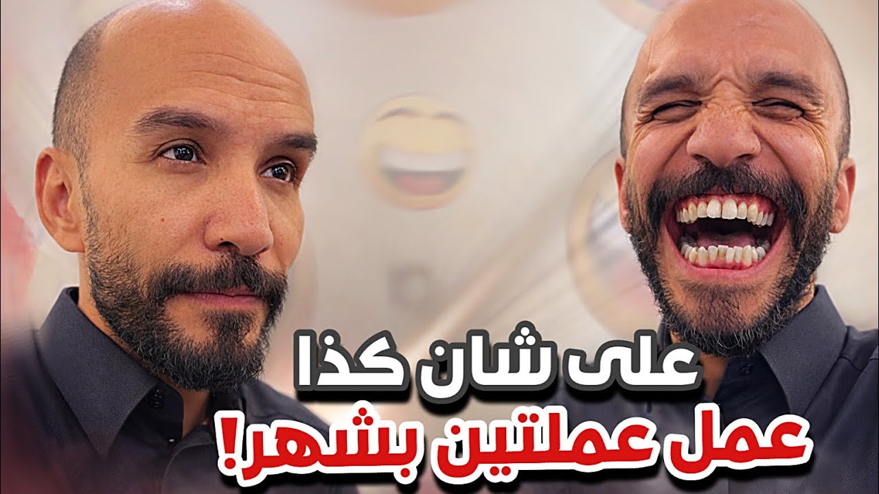 على شان كذا عمل عمليتين بشهر 😂😂سنابات ابوحصة و ابوعجيب