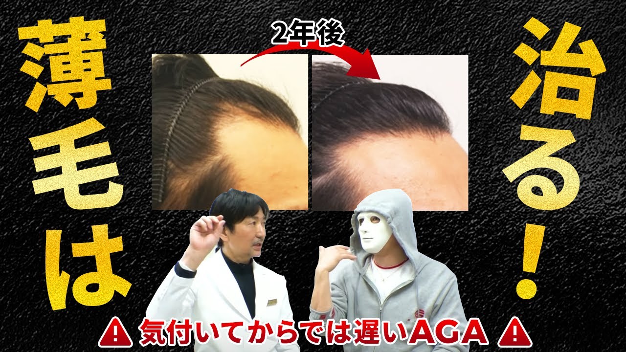 【AGA・ハゲ・薄毛を徹底解説！】AGAとは何？ブリーチしてる人は禿げやすいの？薄毛の原因は？予防法は何をすれば良いの？ラファエルさんが徹底的に質問します！【湘南美容クリニック】