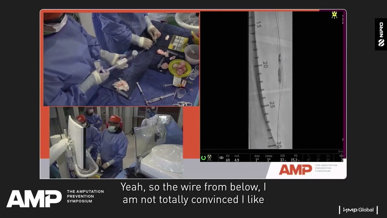 Game-Changing Strategies in Peripheral Intervention