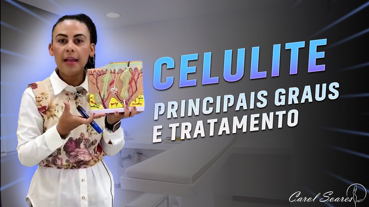 CELULITE - Aula Completa (Sem complicação)