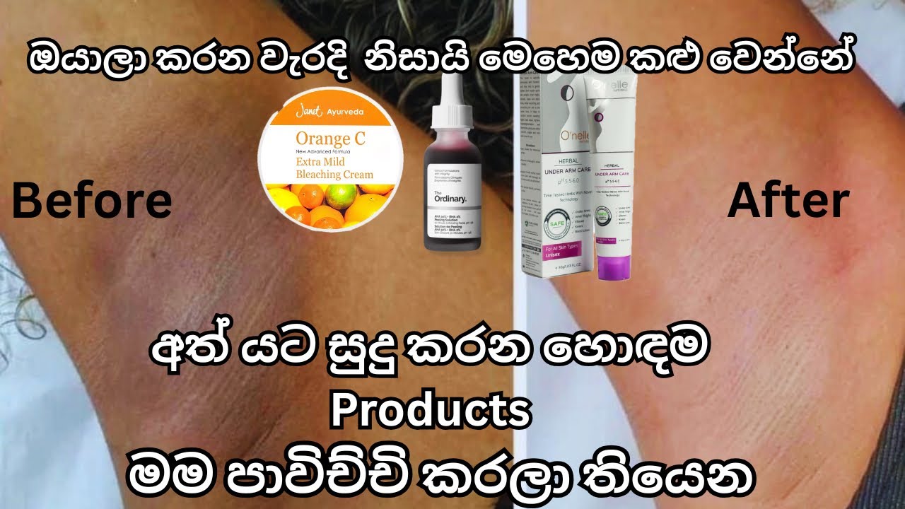 අත් යට සුදු කරන හොඳම products 😍 Best product for dark underarms 😌#darkunderarms #sinhala #viral 