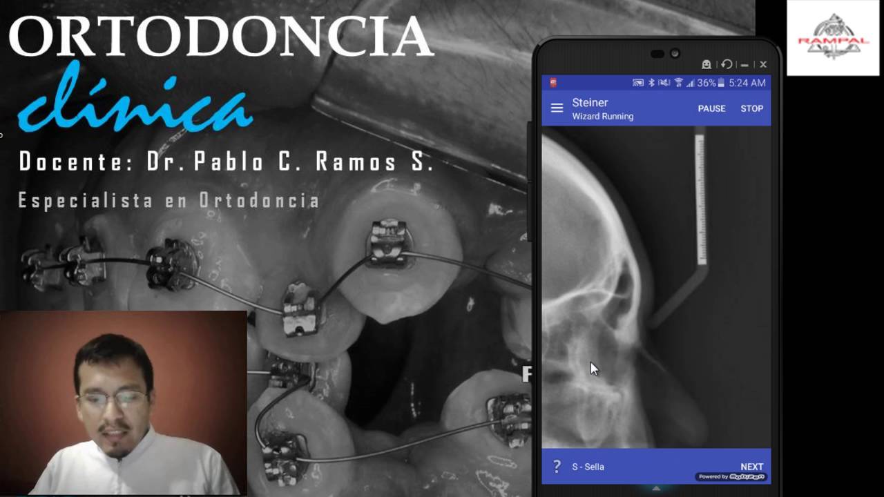 Tip Rampal N°14: Como hacer analisis cefalometricos con el celular