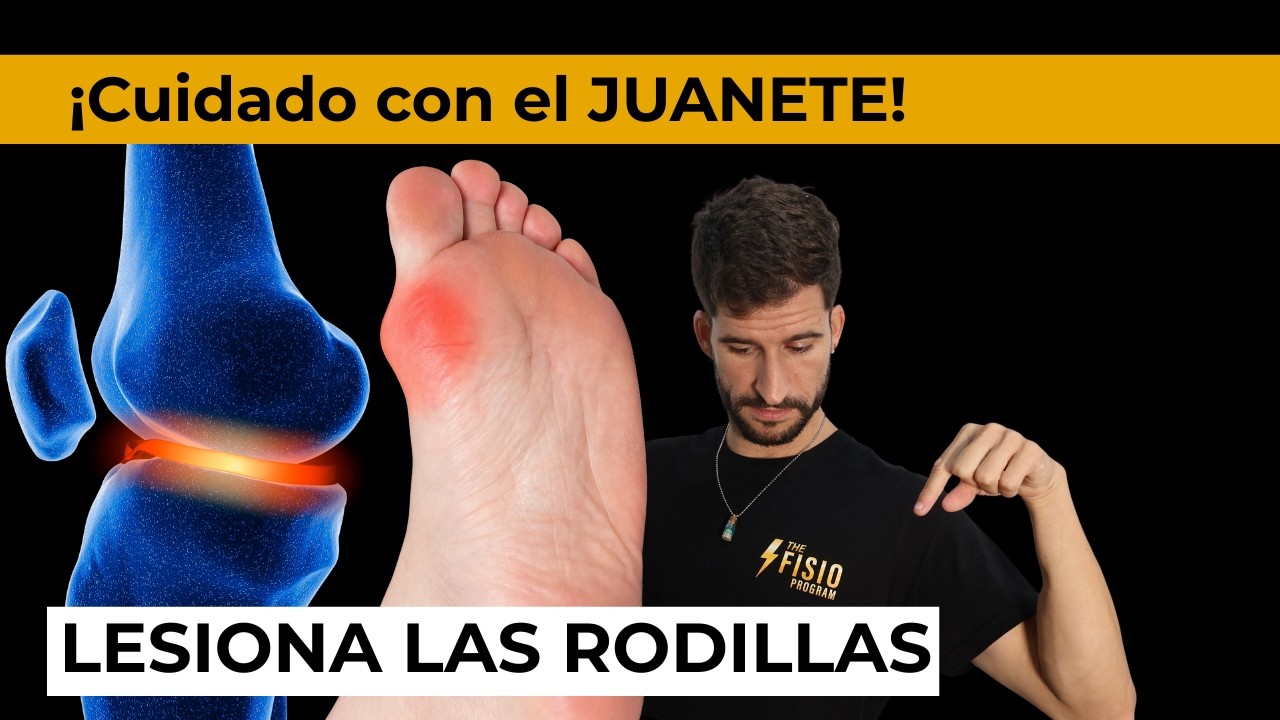 C&oacute;mo un JUANETE puede provocar DOLOR DE RODILLA y qu&eacute; debe hacer un FISIOTERAPEUTA