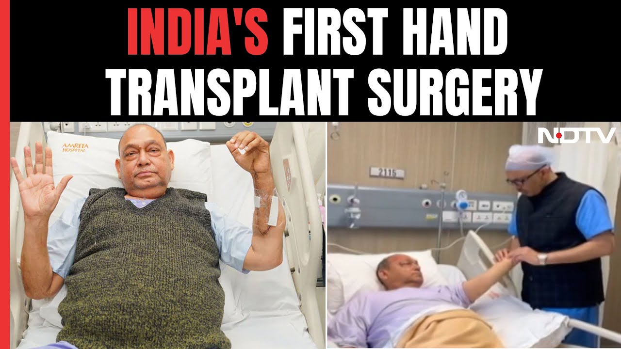 In A First, Hand Transplant Surgery Carried Out At Haryana Hospital
