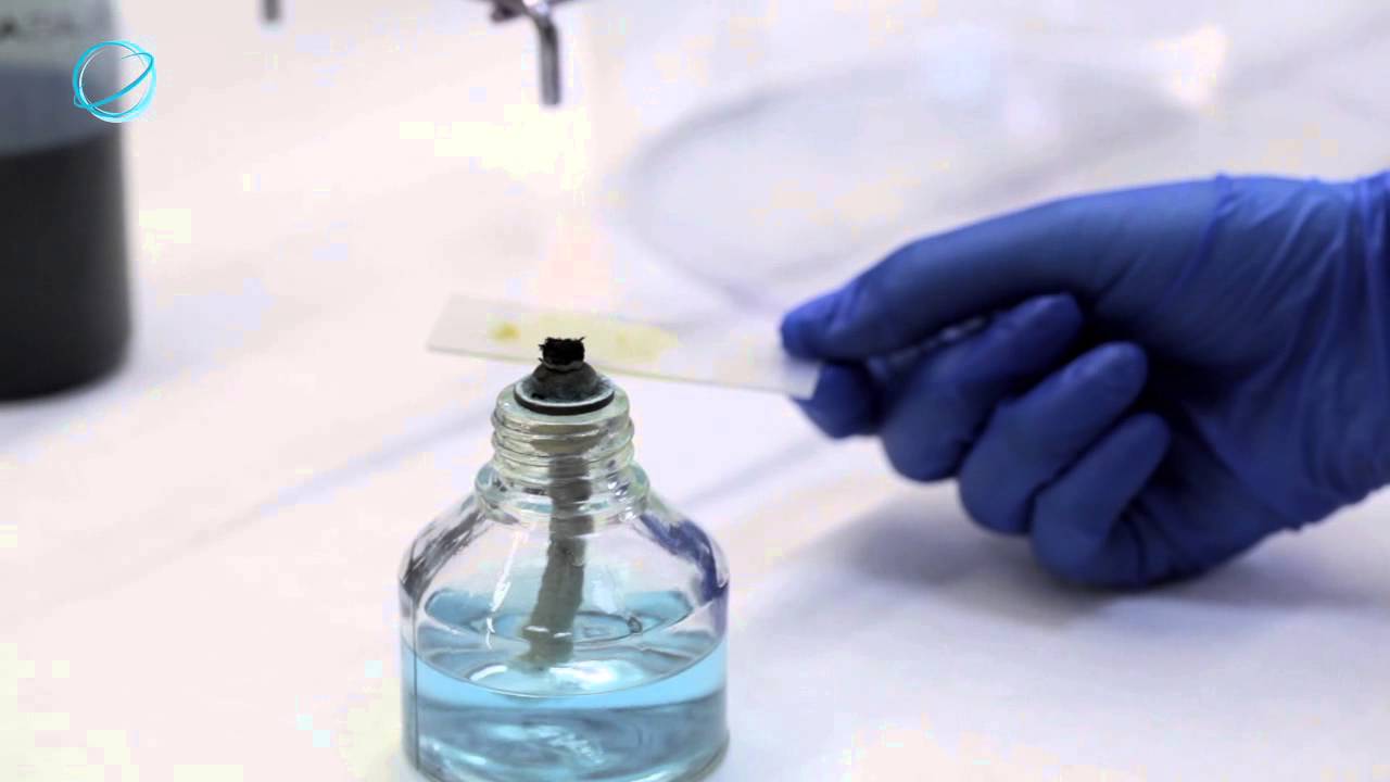 EHAS: Diagnóstico de Parásitos Intestinales (Tinción de Ziehl Neelsen modificada)