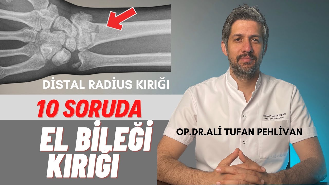 El Bileği Kırığı Nedir// El Bileği Kırığı Nasıl Tedavi Edilir?