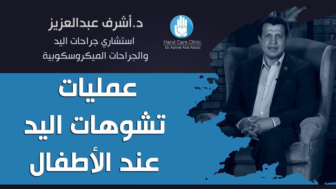 امتي نعمل عمليات تشوهات اليد عند الأطفال