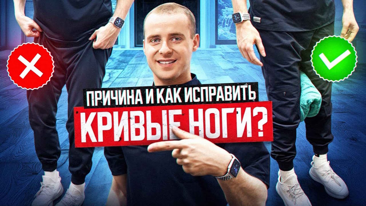 Кривые ноги ? Причина и как исправить этот недуг ? Ноги Анжелины Джолли.
