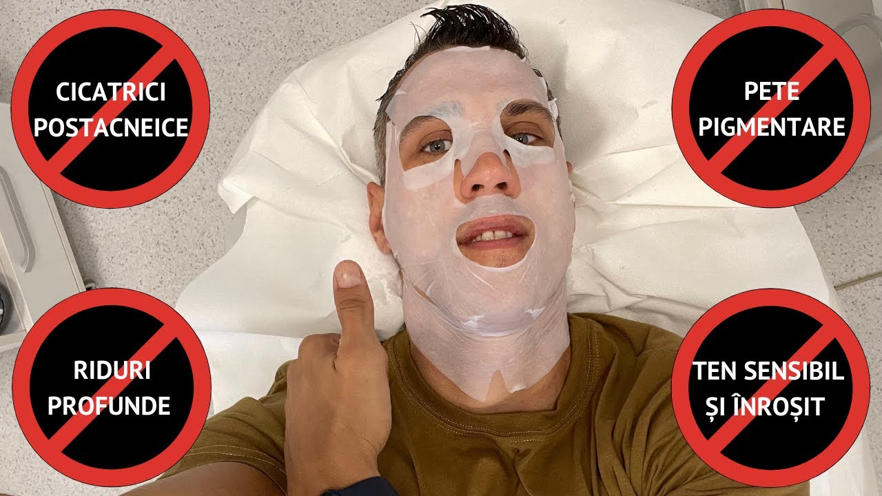 Tratament Facial Antirid, &Icirc;ntinerire, Cicatrici Postacneice și Fermitate cu SPN6 la aBeauty Clinique