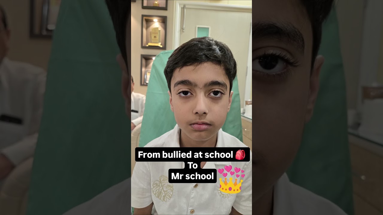 Child Squint surgery #visioncarehospital