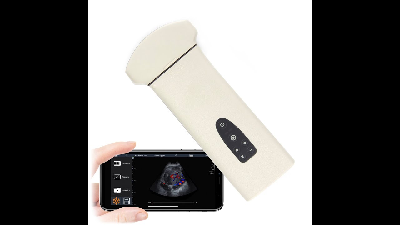 Youkey D8 Portable Ultrasound 