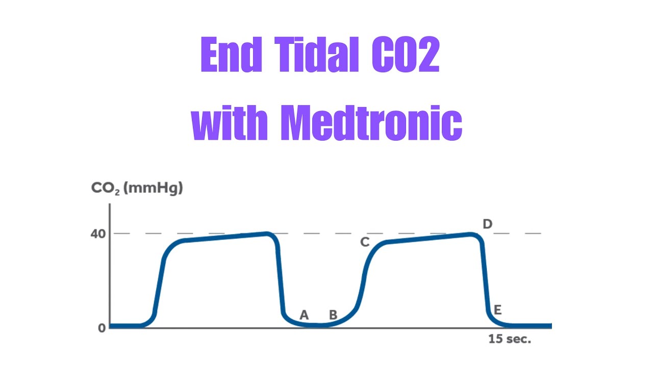ETCO2