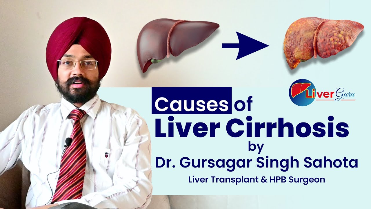 CAUSES OF LIVER CIRRHOSIS By Dr. Gursagar Singh Sahota | LiverGuru