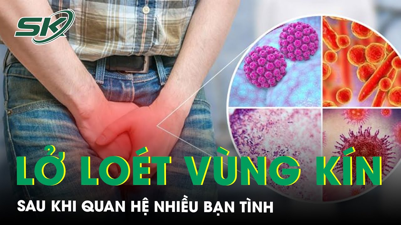 Quan hệ nhiều bạn tình, nam thanh niên mắc giang mai, lở loét vùng kín | SKĐS