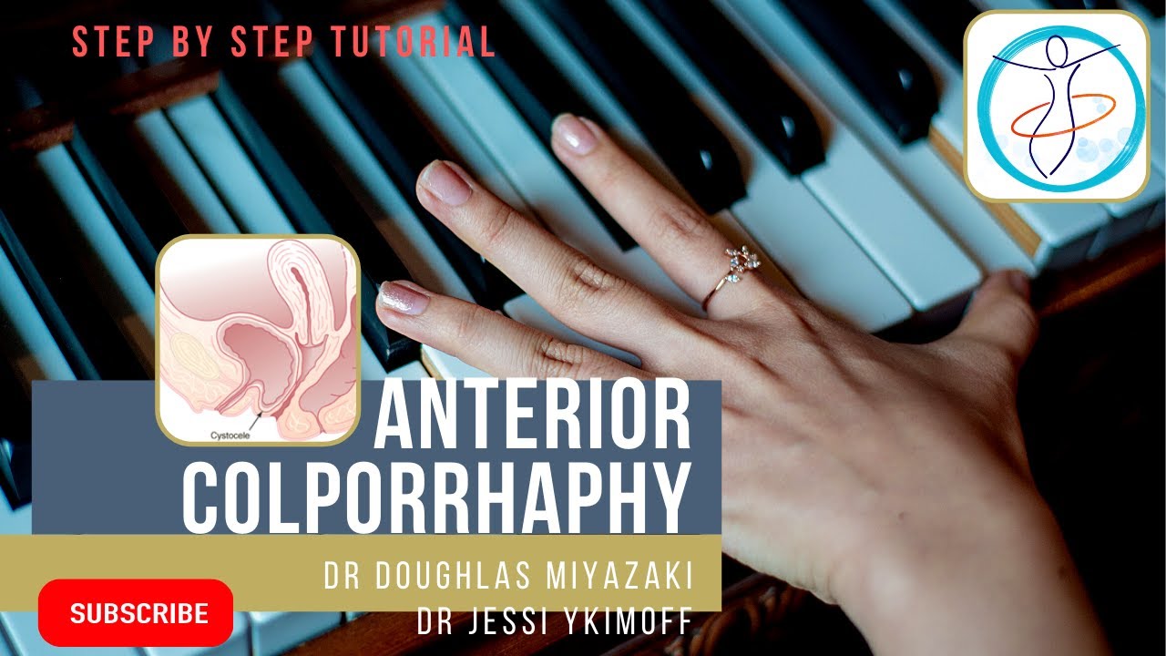 Anterior Colporrhaphy | Cystocoele repair | step wise demonstration