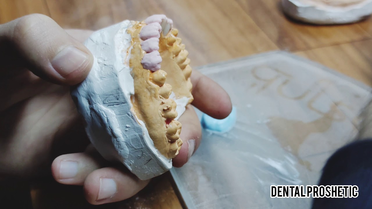 🦷 Zirkonyum Porselen Tepimi Dentin 1