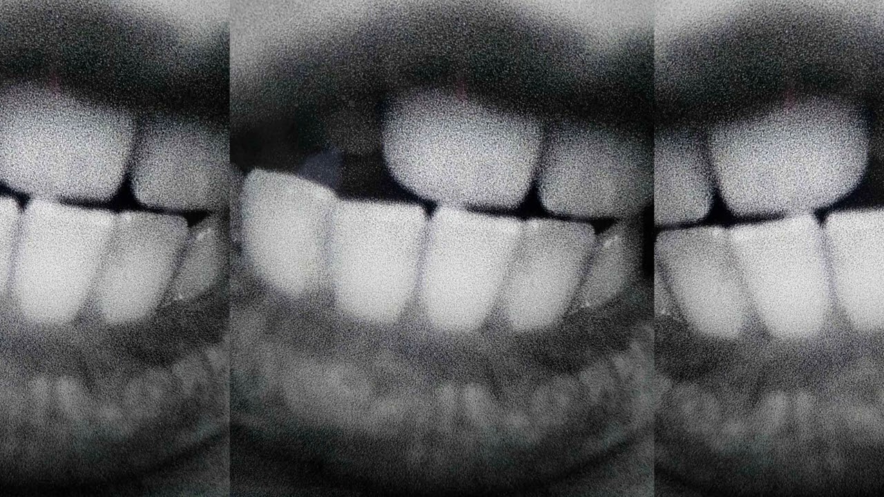 (FREE) Alternative Rock x Artemas x Lovecore Type Beat - BetweenUs
