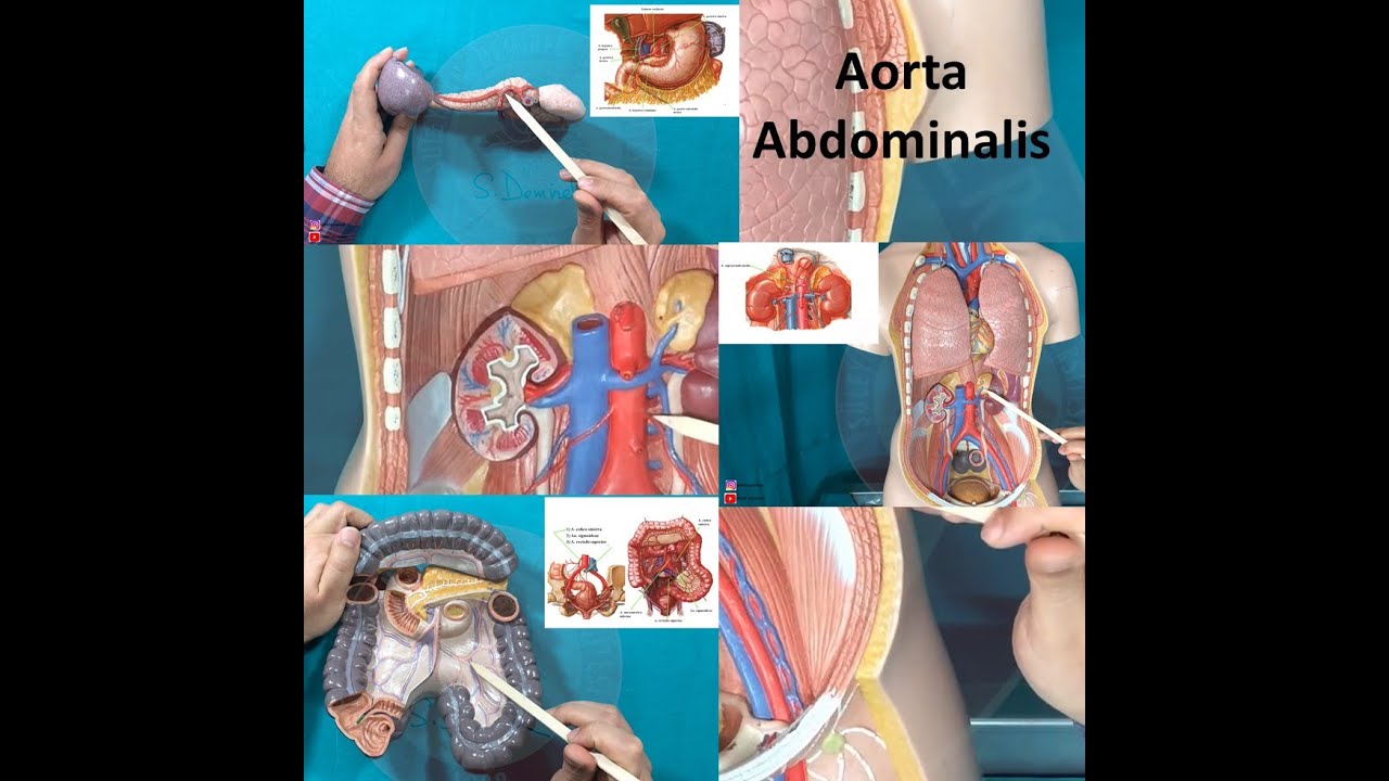Aorta Abdominalis ve Dalları