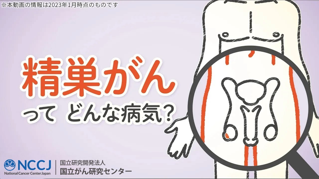 【精巣がん】どんな病気？初期症状と今日から始められるセルフチェックについても解説！