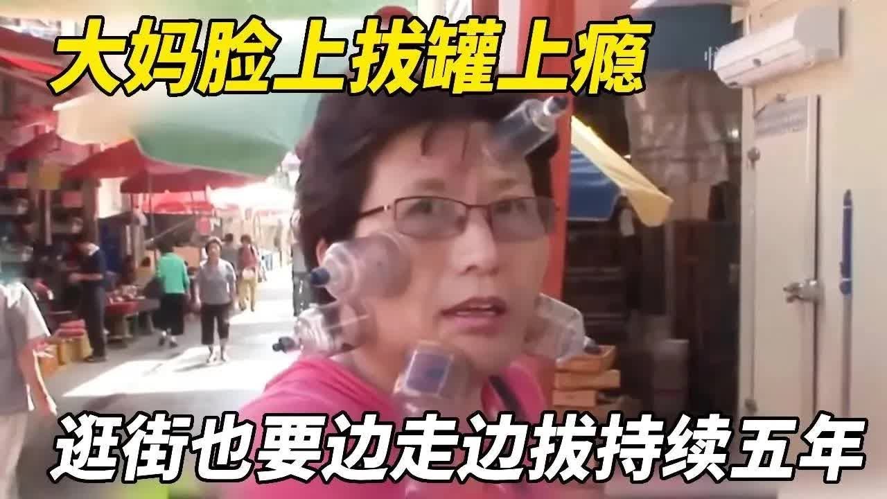 大妈每天都在脸上拔罐，逛街也要边走边拔，这样子已经持续五年！【悦贝电影】