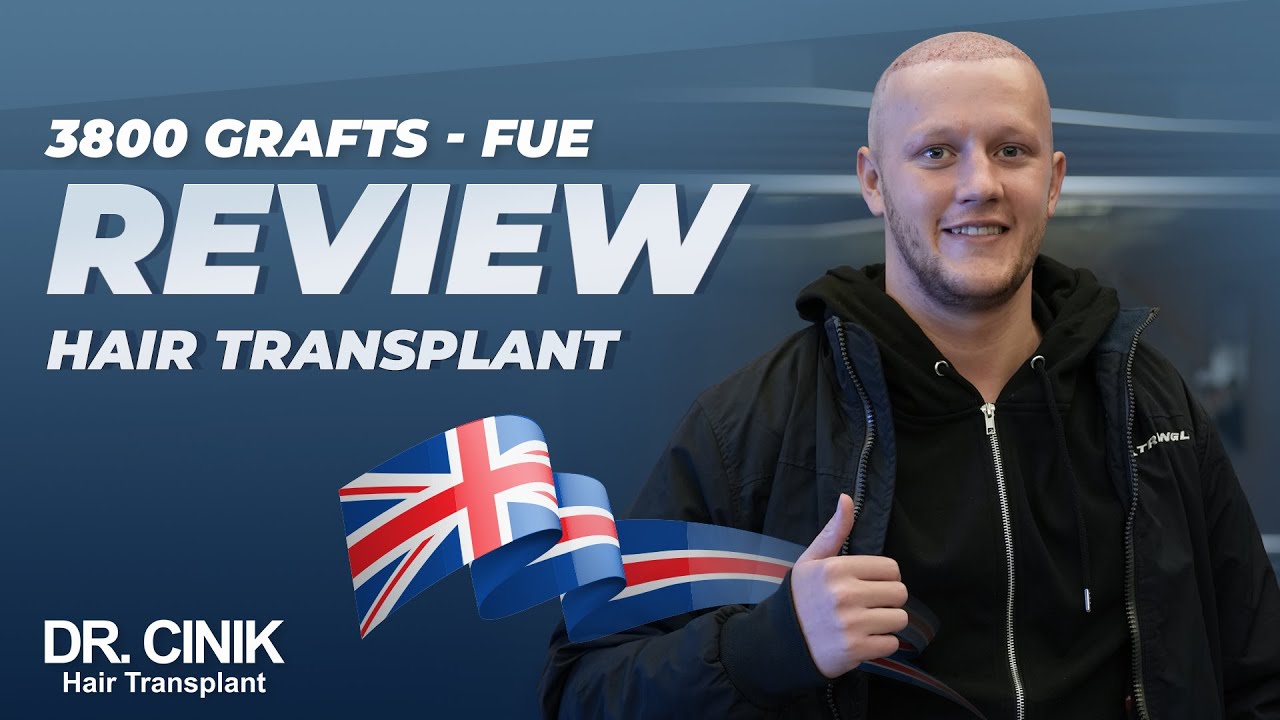 Dr.Cinik Hair Transplant | FUE Sapphire | 3800 Grafts | Nathan Martin Review