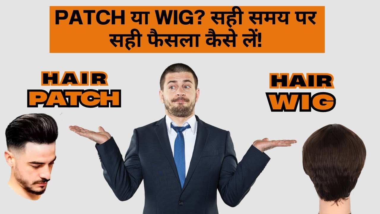 Patch या Wig? सही समय पर सही फैसला कैसे लें |Hair Patch & Hair Wig बिना सर्जरी के | #hairpatch #wig