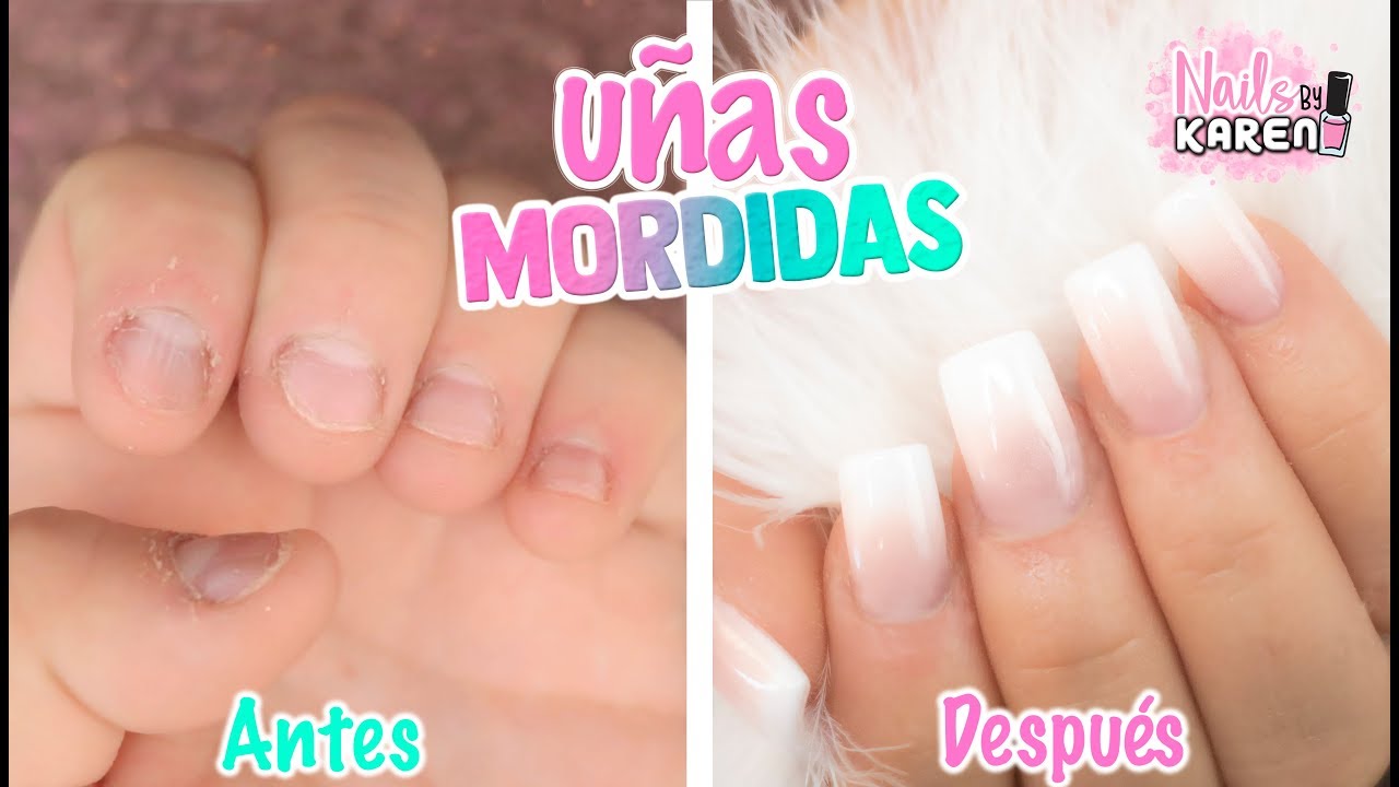 UÑAS MORDIDAS | Onicofagia CAMBIO TOTAL!!