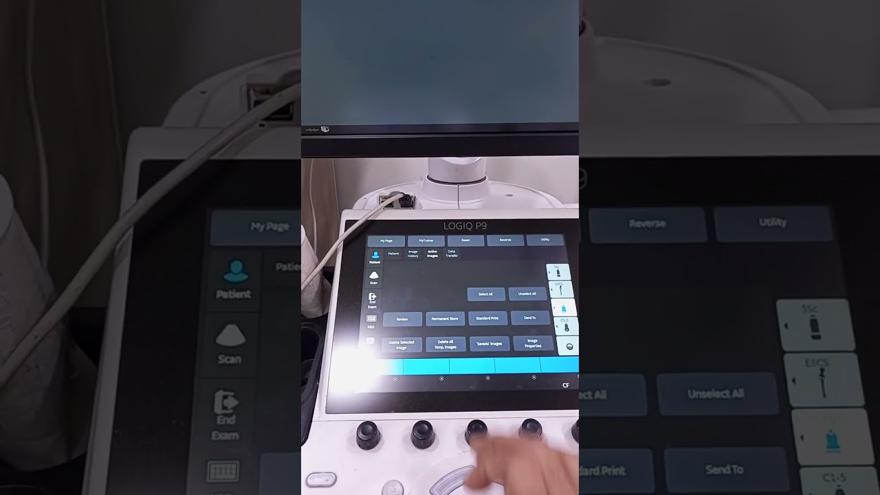 Vascular Doppler ultrasound