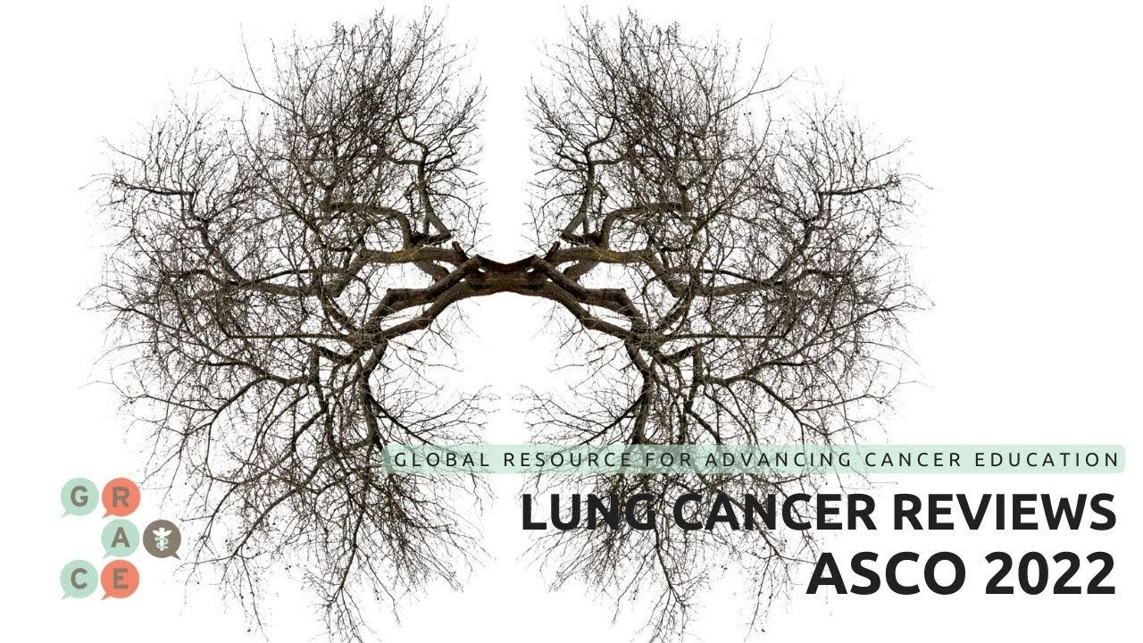 Checkmate 816: Combining Chemo and Opdivo - ASCO Lung Review 2022