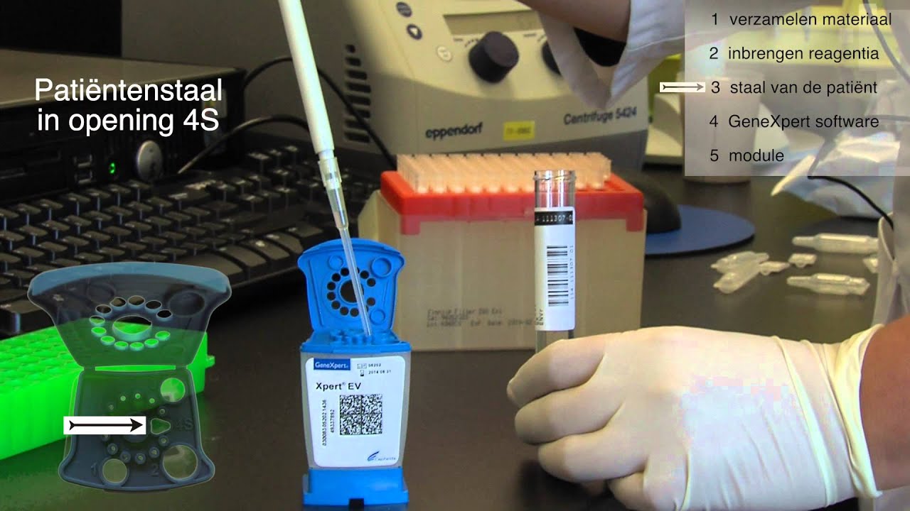 GeneXpert procedure