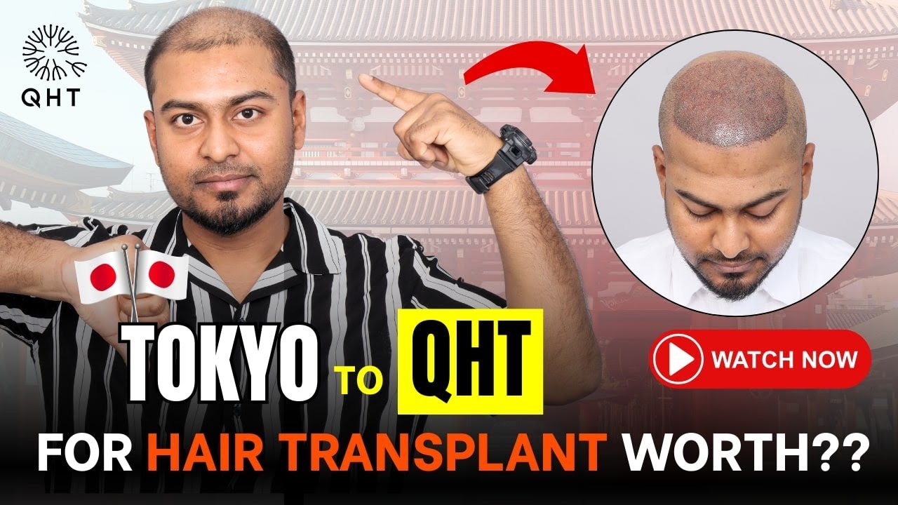FUE Hair Transplant | Best Cost & Results of FUE Hair Transplant