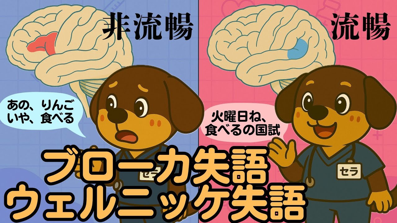 【短編】ブローカ失語 ウェルニッケ失語とは？　かるーく解説！#国家試験 #作業療法 #理学療法 #リハ学生　#看護学生　#医療学生　#失語　#ブローカ失語　#ウェルニッケ失語