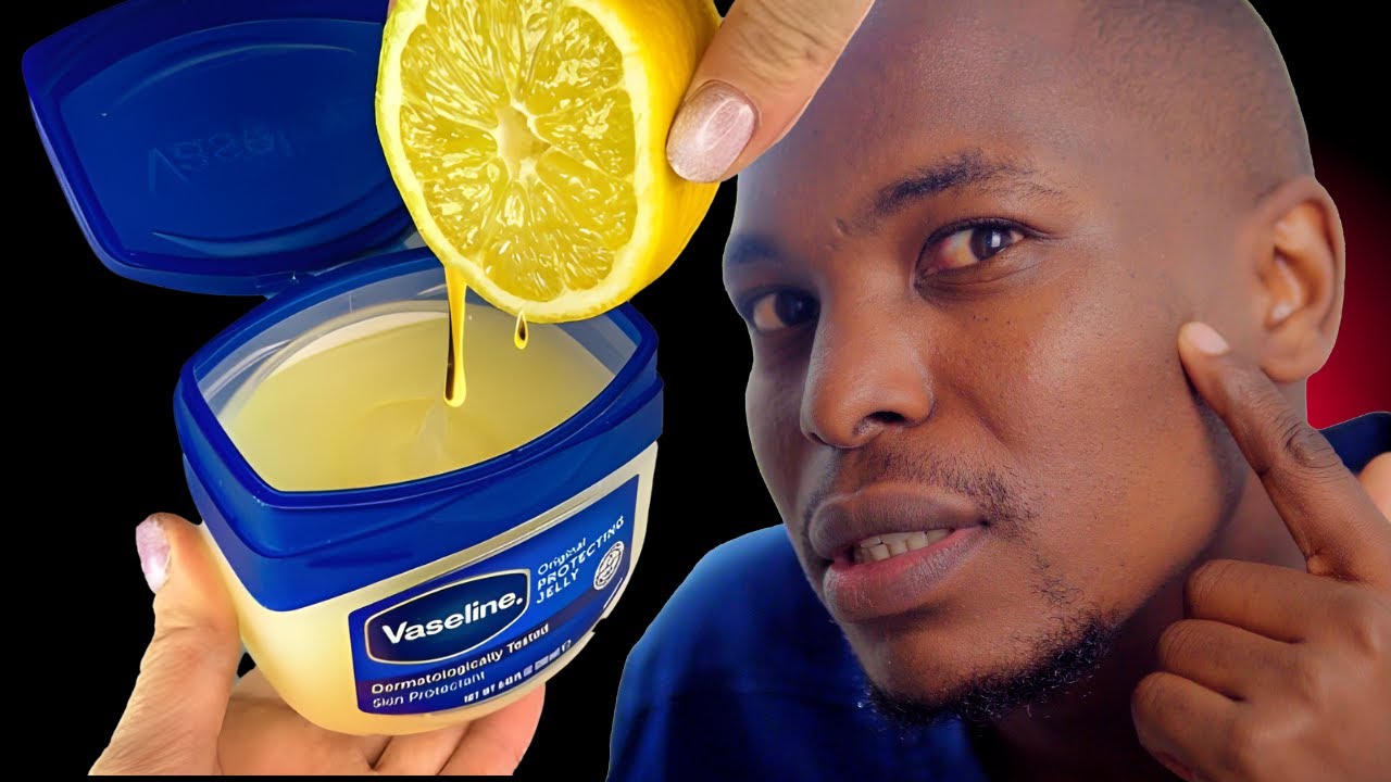 I Mixed Vaseline and Lemon and Used it on my Face for 7 days - Day 1