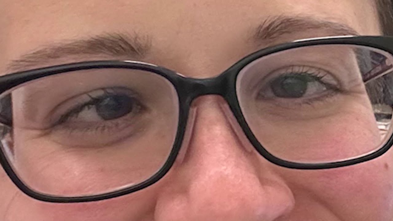 Strabismus treatment gives woman a new outlook on life