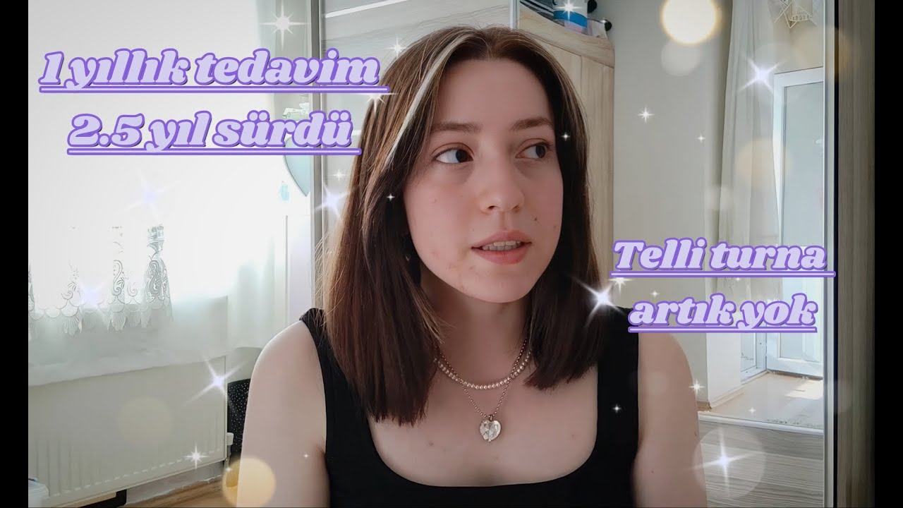 Diş teli sürecim / memnun kaldım mı?