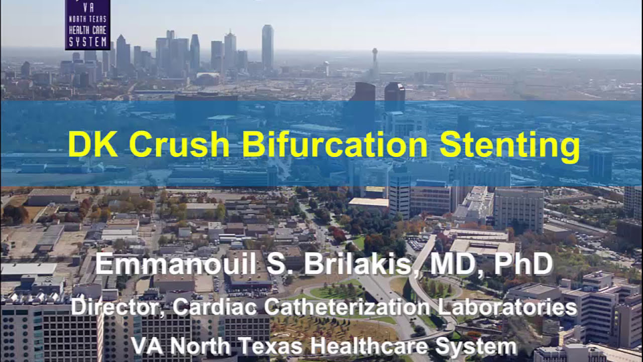 How to perform the DK crush technique for bifurcation stenting