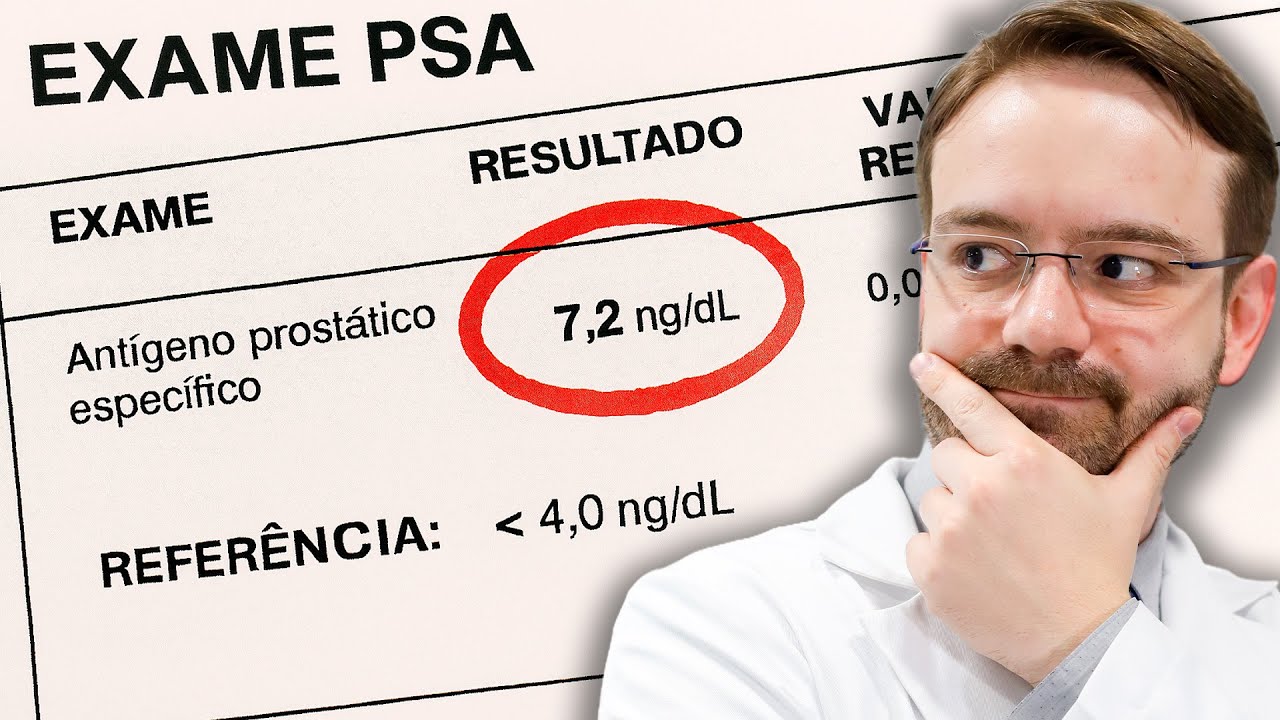 O Que Nunca Te Contaram Sobre o SEU PSA