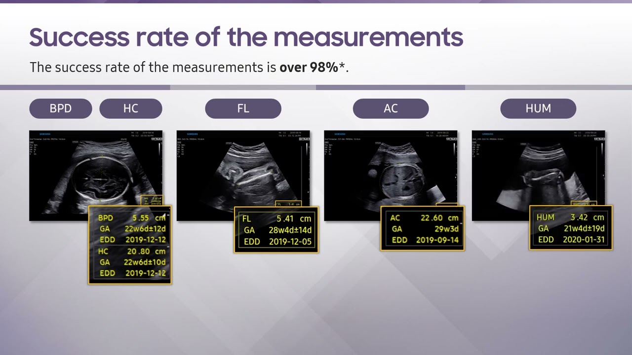 Samsung Intelligent Assist Technology for Women's Health