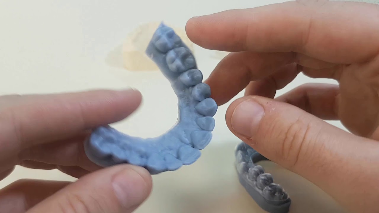 3D printing dental models: material comparison and tips