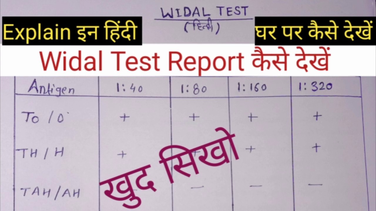 घर पर टायफायड रिपोर्ट कैसे चैक करें | How To Read Typhoid (Widal Test) Report  At Home