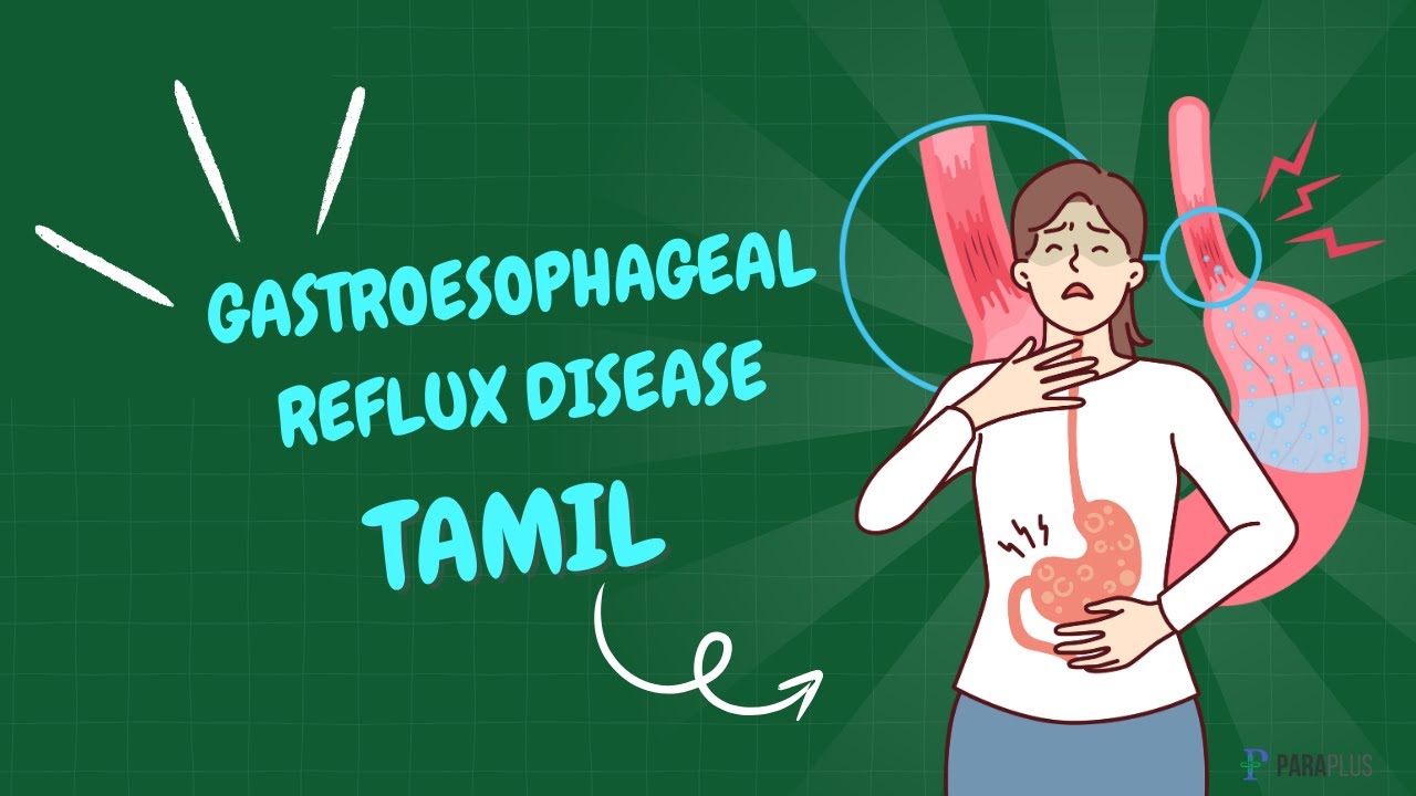 GERD in Tamil: Definition, Types, Symptoms, Causes, Pathophysiology, and Management