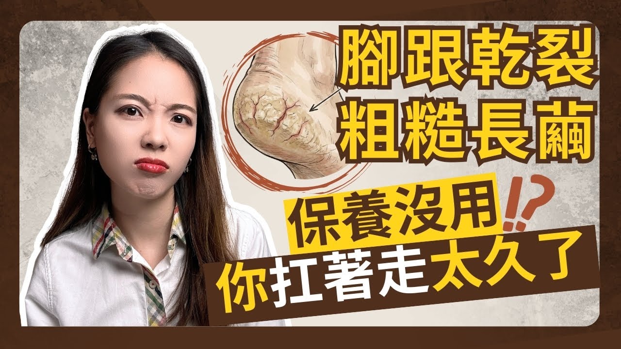 【3分鐘身體密碼】腳後跟乾裂粗厚？因為你總是「靠自己撐著走」｜Nina蕭業力身心轉化室