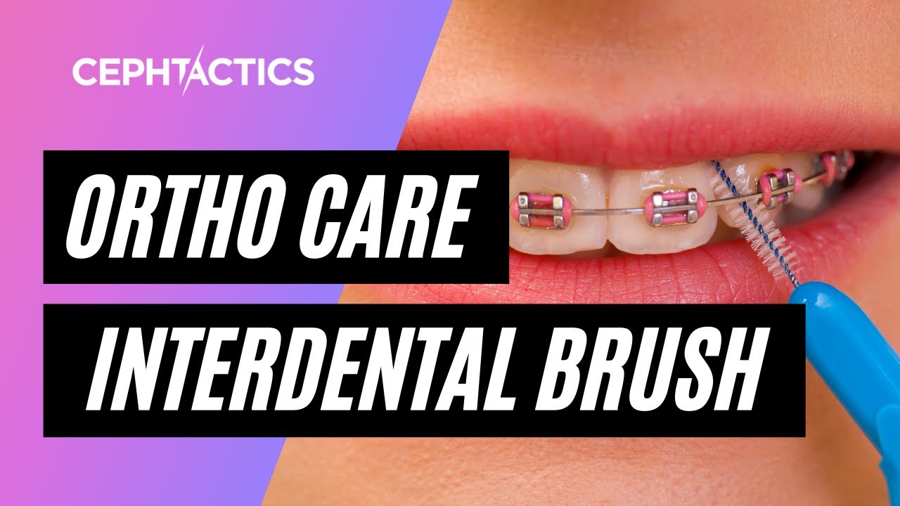 Interdental Brush - How to use (Orthodontic Care)