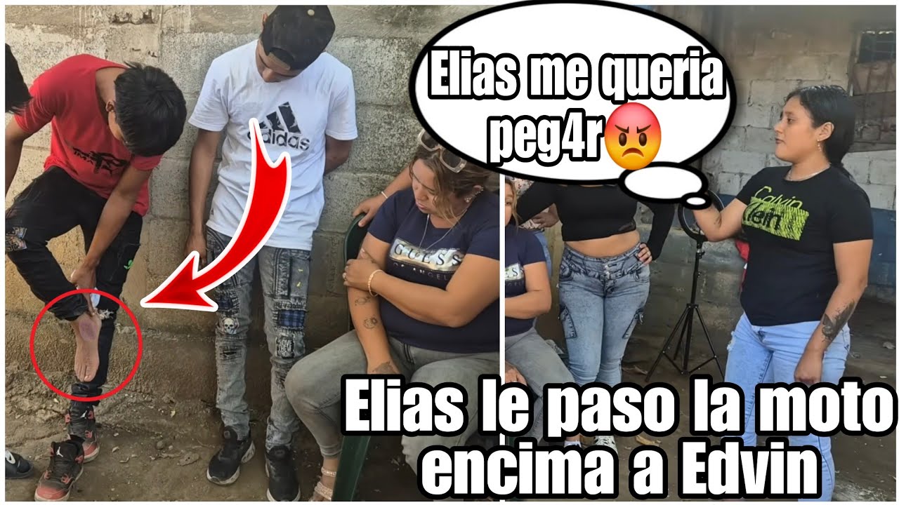 Dios Mio Elias le queria tron4r la cara a Dayana Edvin por defendería se fracturó el pie😨