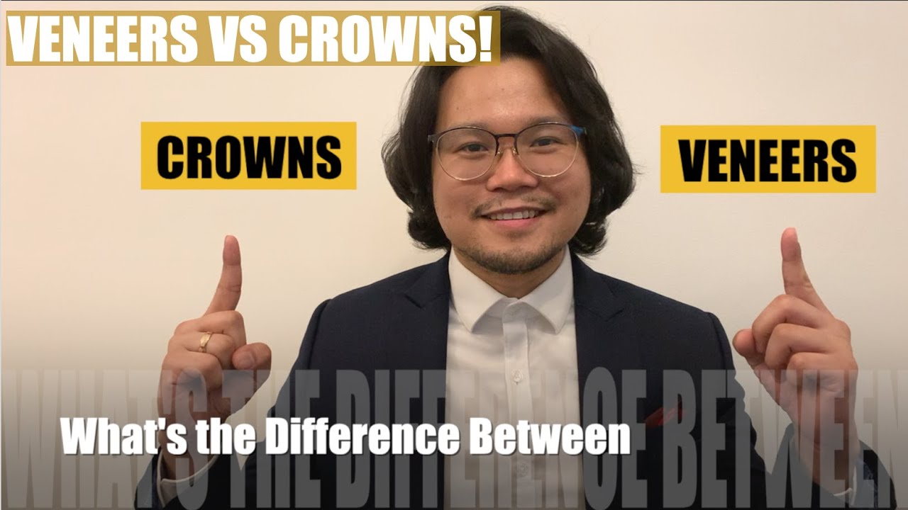 Veneers VS Crowns | Apostol Dental Philippines