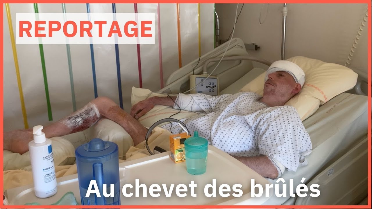 Soigner les victimes de brûlures ou 